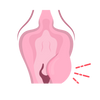 Jeuk rondom je vulva